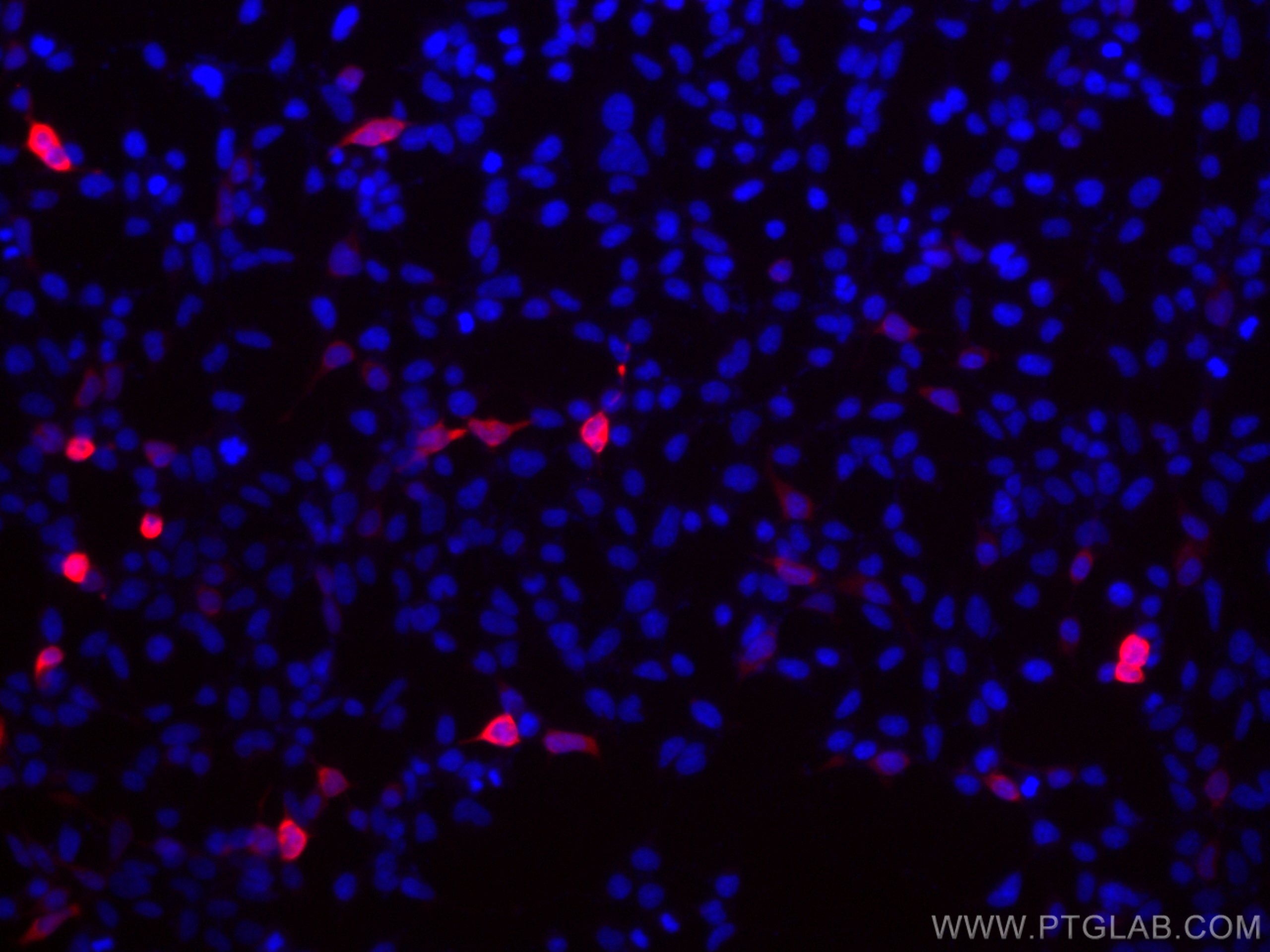 Immunofluorescence (IF) / fluorescent staining of Transfected HEK-293 cells using CoraLite®594-conjugated GFP tag Polyclonal antibod (CL594-50430)