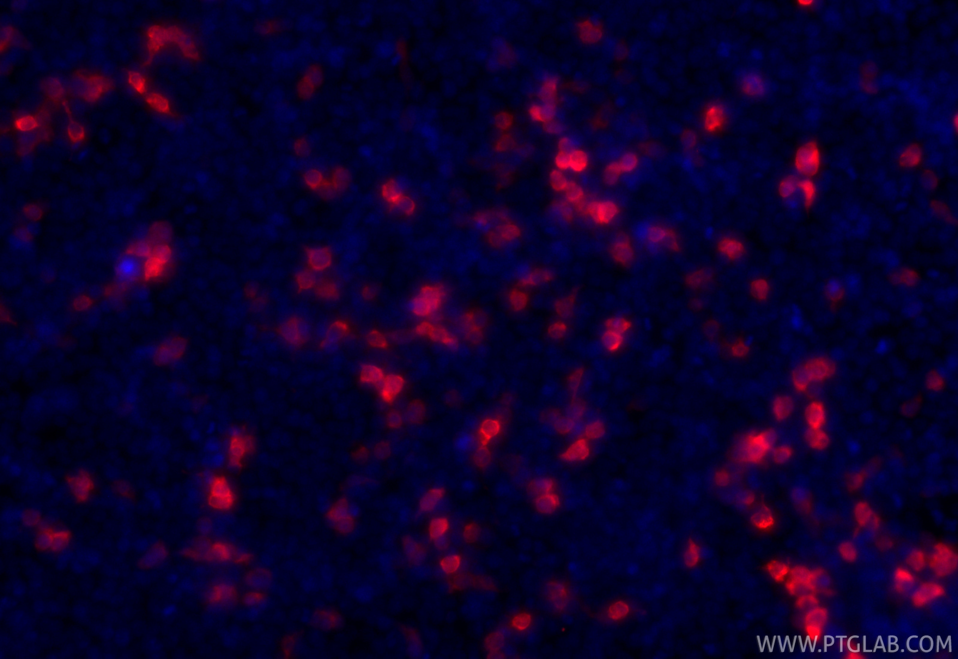 IF Staining of Transfected HEK-293 using CL594-50430 Immunofluorescence (IF) / fluorescent staining of Transfected HEK-293 cells using CoraLite®594-conjugated GFP tag Polyclonal antibod (CL594-50430)