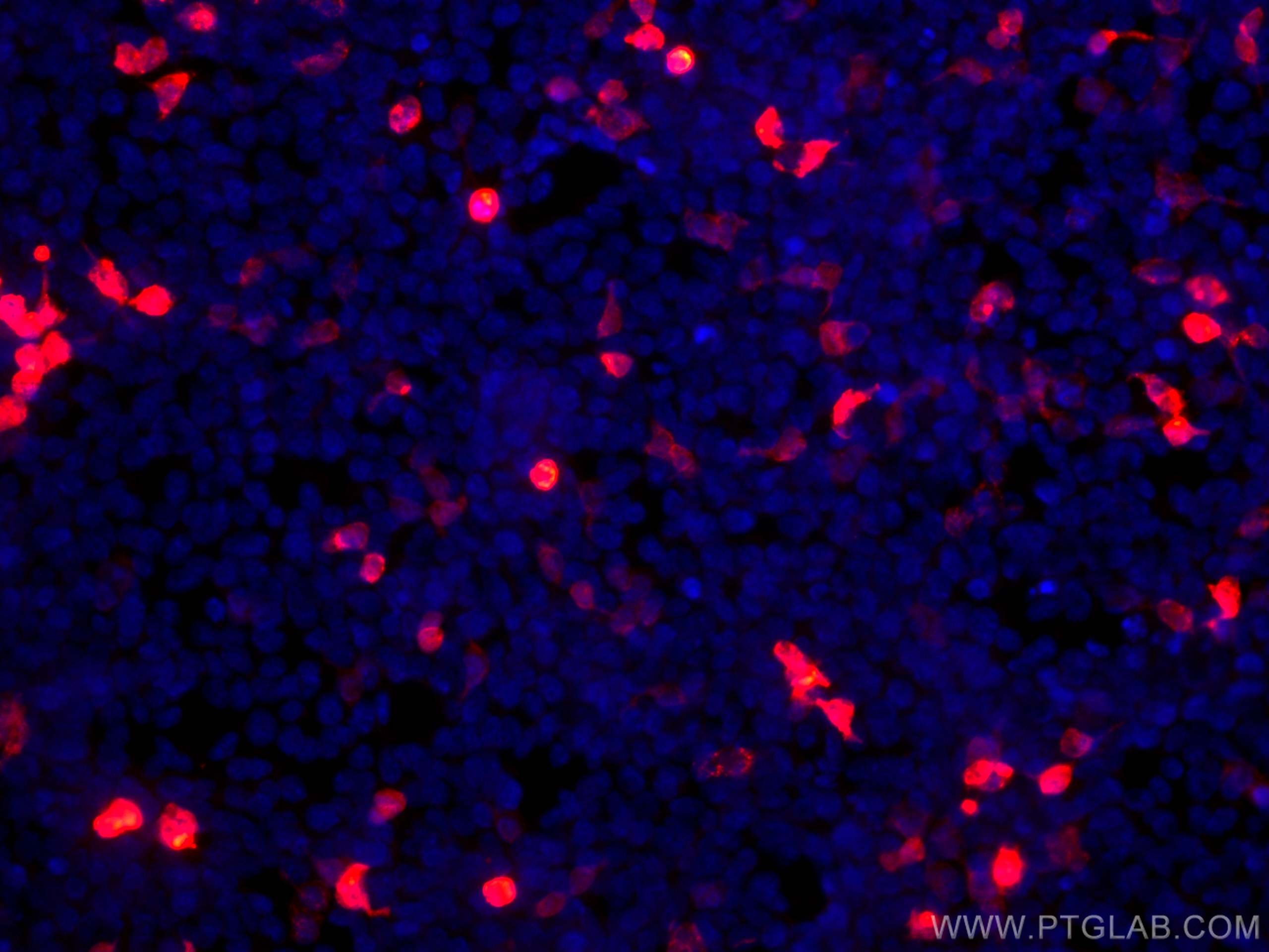 Immunofluorescence (IF) / fluorescent staining of Transfected HEK-293 cells using CoraLite®594-conjugated GFP tag Monoclonal antibod (CL594-66002)