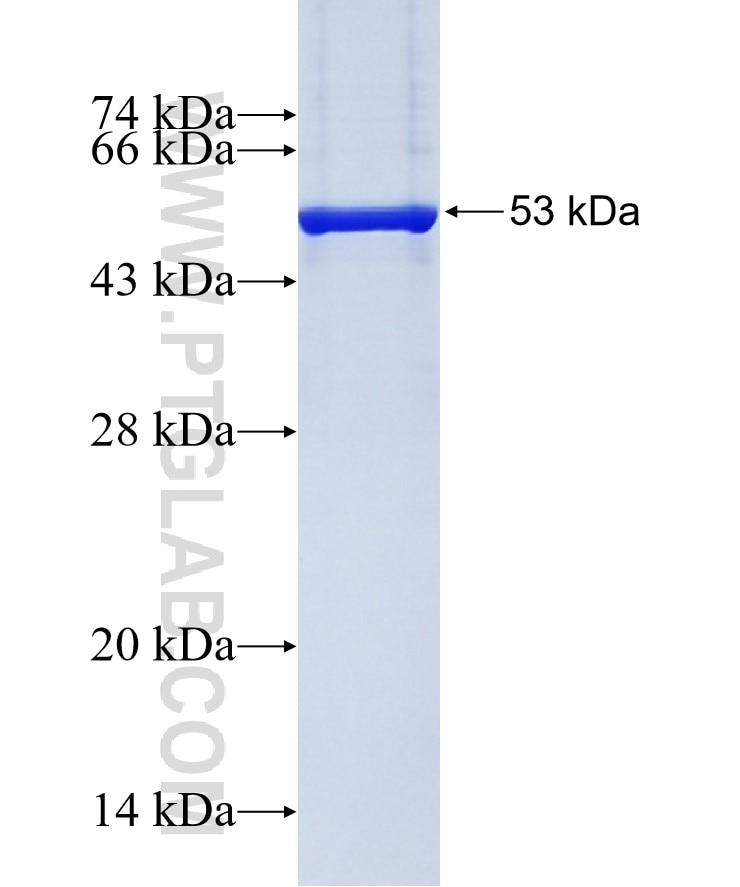 GFP tag fusion protein Ag2128 SDS-PAGE
