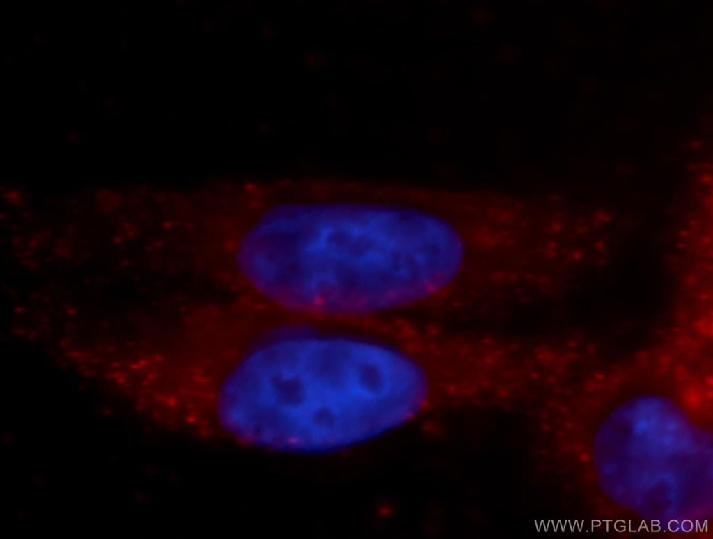 Immunofluorescence (IF) / fluorescent staining of HepG2 cells using GFPT1 Polyclonal antibody (14132-1-AP)