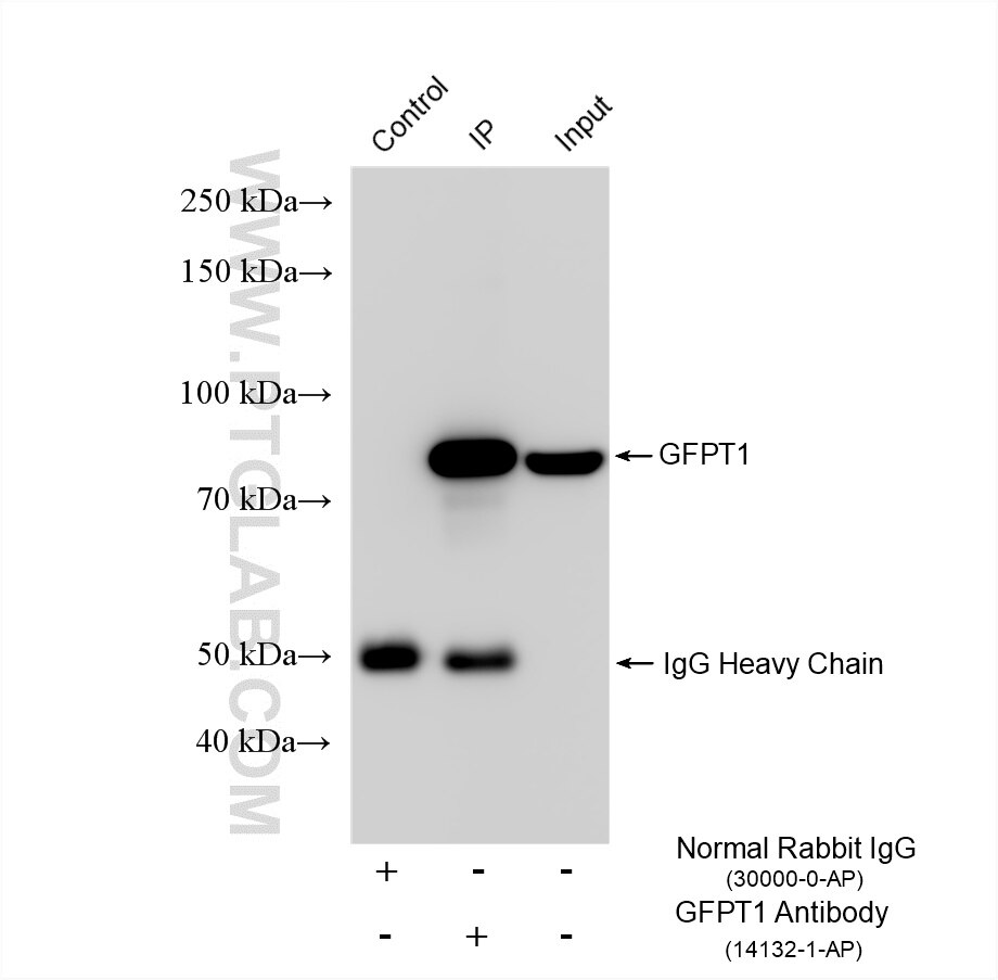 Immunoprecipitation (IP) experiment of HepG2 cells using GFPT1 Polyclonal antibody (14132-1-AP)
