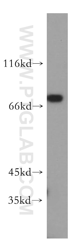 Western Blot (WB) analysis of HepG2 cells using GFPT1 Polyclonal antibody (14132-1-AP)