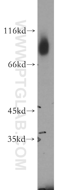 Western Blot (WB) analysis of human skeletal muscle tissue using GFPT1 Polyclonal antibody (14132-1-AP)