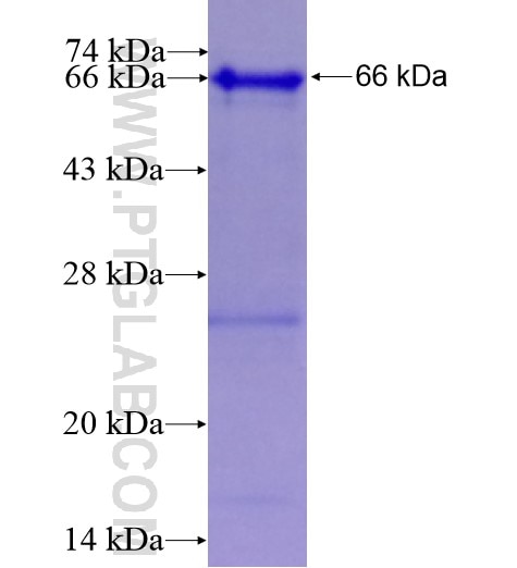 GFPT1 fusion protein Ag5312 SDS-PAGE