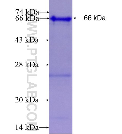 GFPT1 fusion protein Ag5312 SDS-PAGE