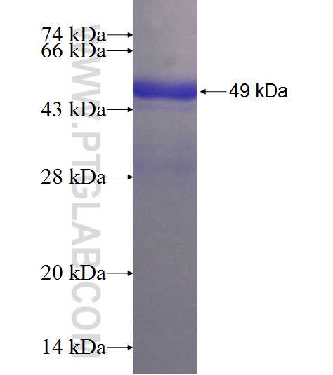 GFPT1 fusion protein Ag6855 SDS-PAGE