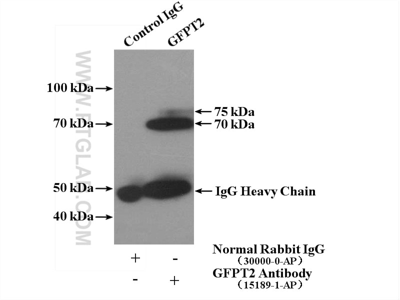 Immunoprecipitation (IP) experiment of HT-1080 cells using GFPT2 Polyclonal antibody (15189-1-AP)