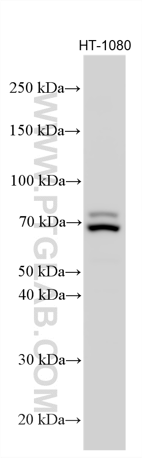 Various lysates were subjected to SDS PAGE followed by western blot with 15189-1-AP (GFPT2 antibody) at dilution of 1:1000 incubated at room temperature for 1.5 hours. Western Blot (WB) analysis of various lysates using GFPT2 Polyclonal antibody (15189-1-AP)