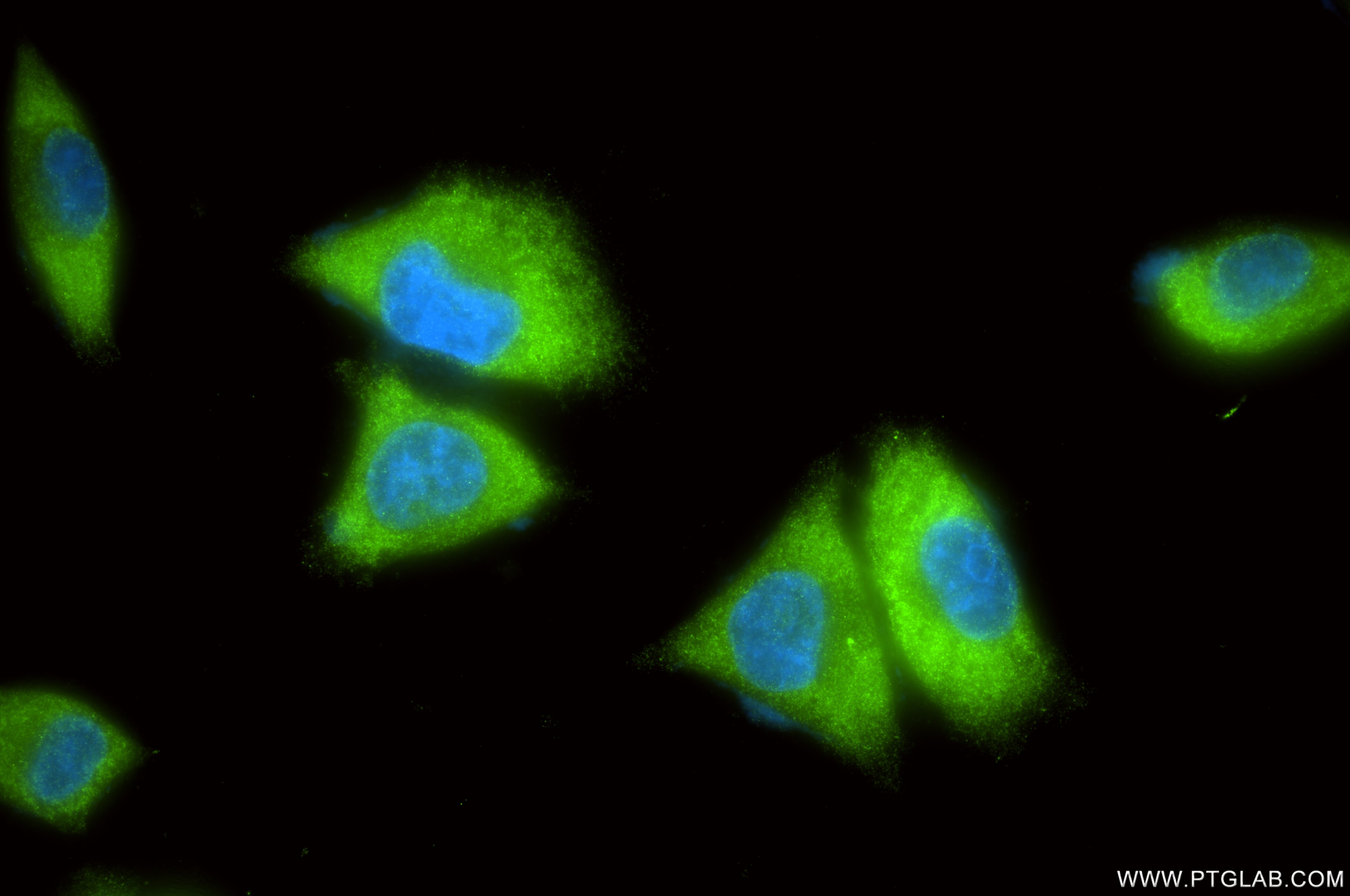 IF Staining of A375 using 86609-3-RR Immunofluorescence (IF) / fluorescent staining of A375 cells using GFPT2 Recombinant monoclonal antibody (86609-3-RR)