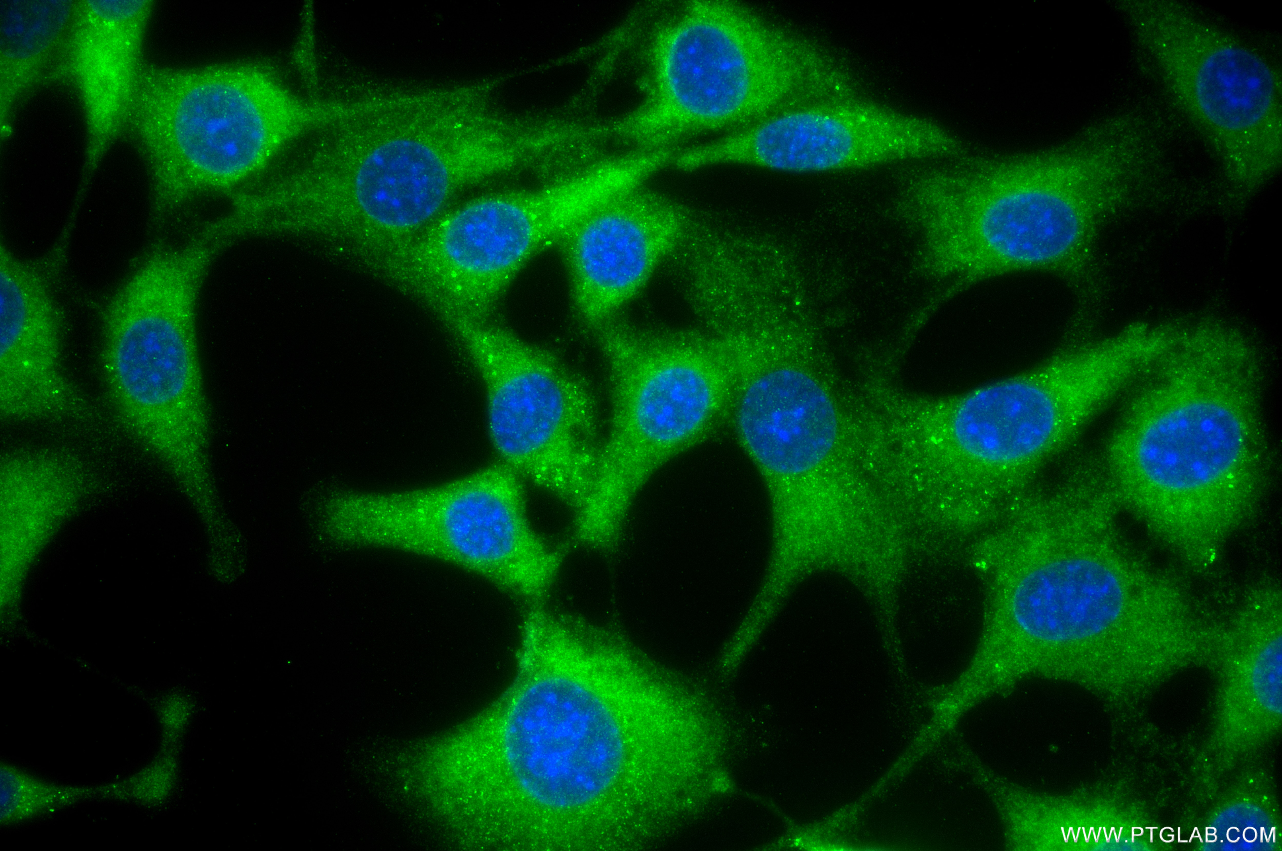 IF Staining of NIH/3T3 using 86609-3-RR Immunofluorescence (IF) / fluorescent staining of NIH/3T3 cells using GFPT2 Recombinant monoclonal antibody (86609-3-RR)