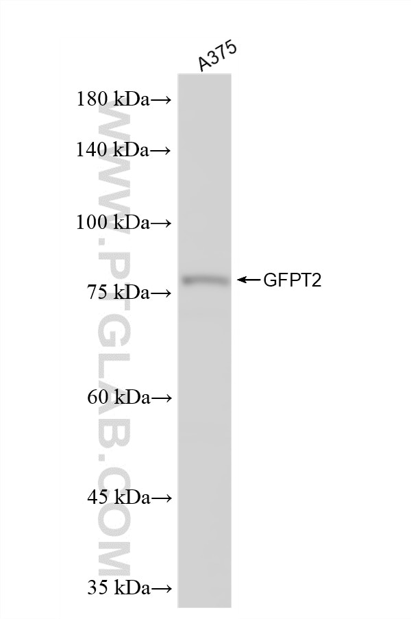 WB analysis of A375 using 86609-3-RR Western Blot (WB) analysis of A375 cells using GFPT2 Recombinant monoclonal antibody (86609-3-RR)