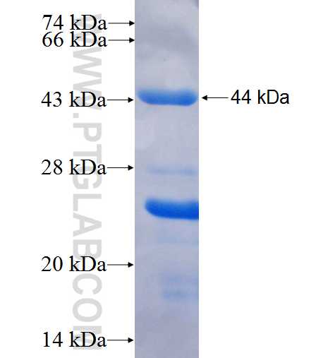 GFPT2 fusion protein Ag7577 SDS-PAGE