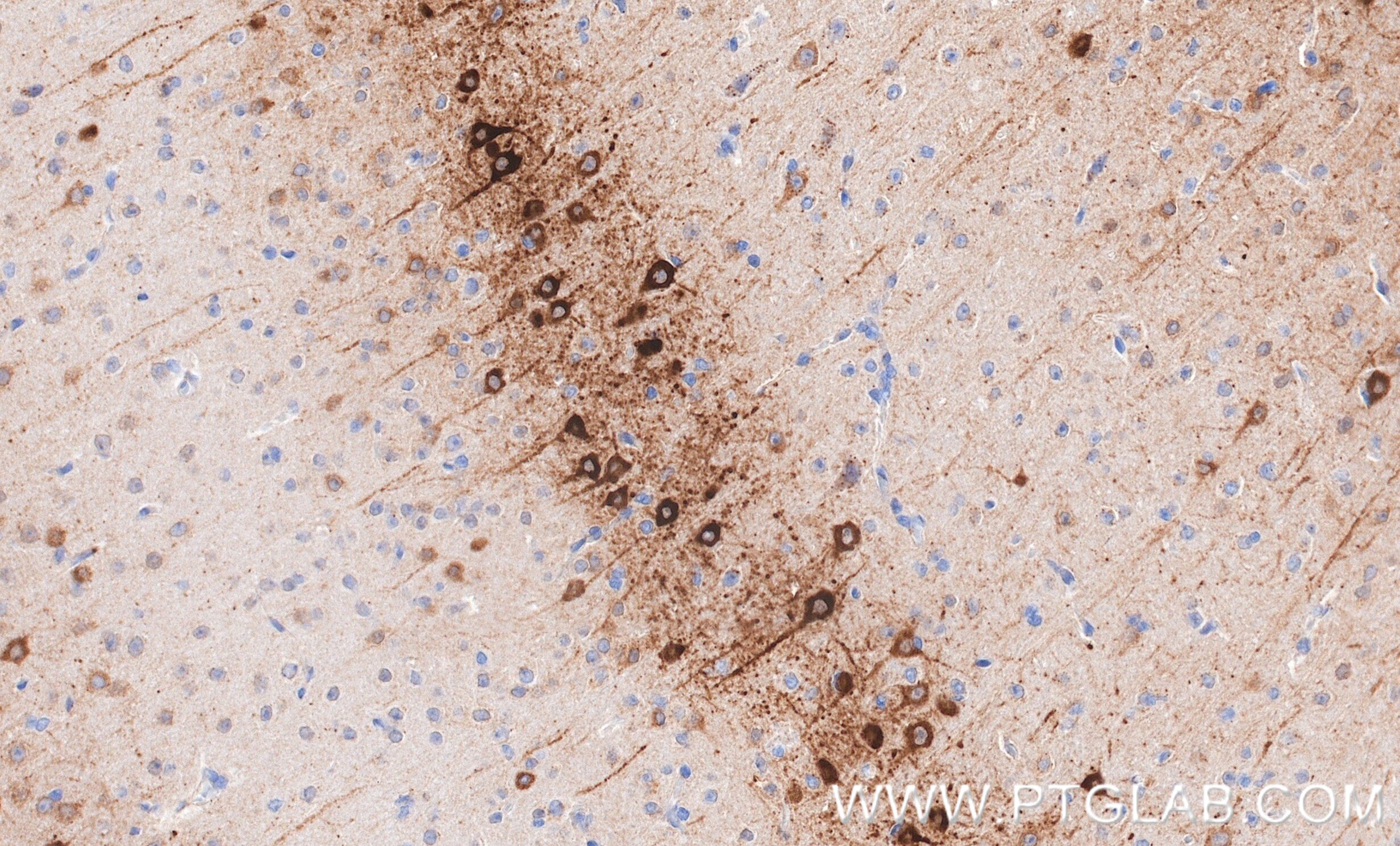 IHC staining of mouse brain using 87383-1-RR (same clone as 87383-1-PBS) Immunohistochemistry (IHC) staining of mouse brain tissue using GFRA1 Recombinant monoclonal antibody (87383-1-RR)