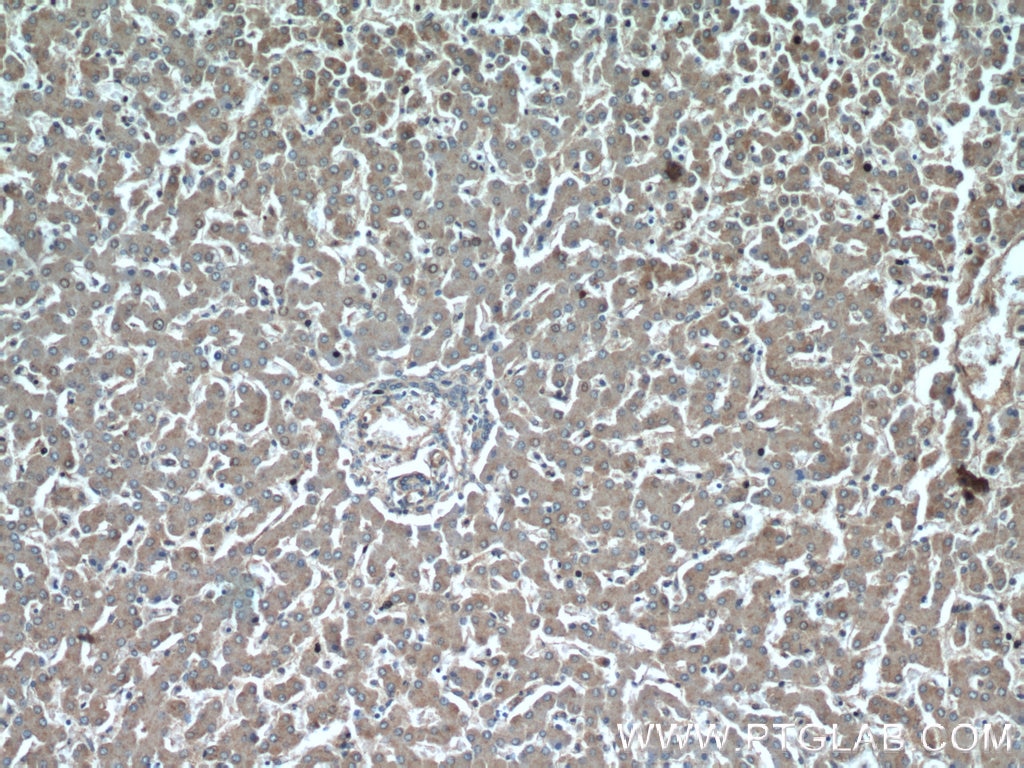 Immunohistochemistry (IHC) staining of human liver tissue using GFRA2 Polyclonal antibody (21973-1-AP)