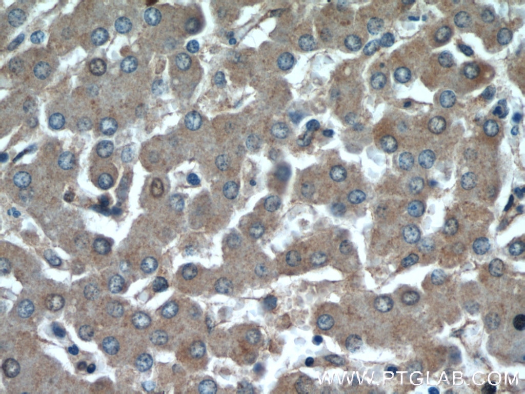 Immunohistochemistry (IHC) staining of human liver tissue using GFRA2 Polyclonal antibody (21973-1-AP)