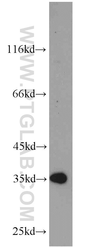 Western Blot (WB) analysis of HepG2 cells using GFRA2 Polyclonal antibody (21973-1-AP)