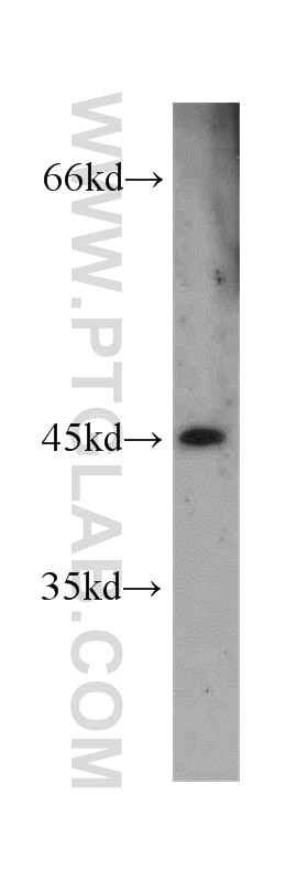 Western Blot (WB) analysis of human placenta tissue using GFRA2 Polyclonal antibody (55038-1-AP)
