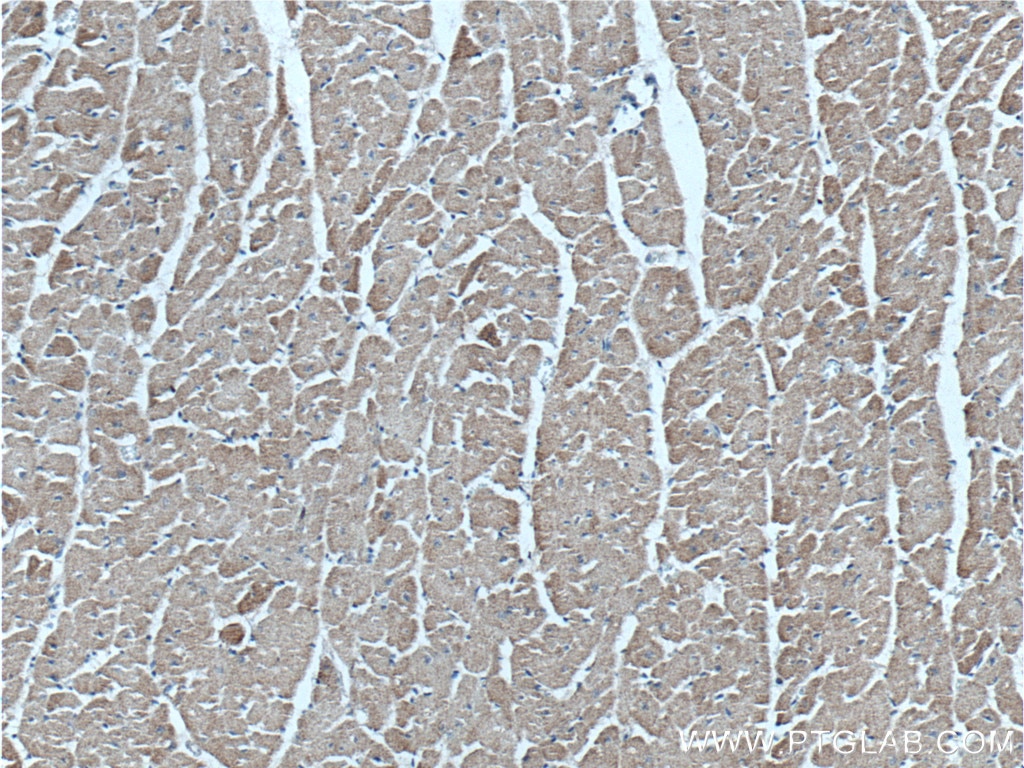 IHC staining of human heart using 25379-1-AP