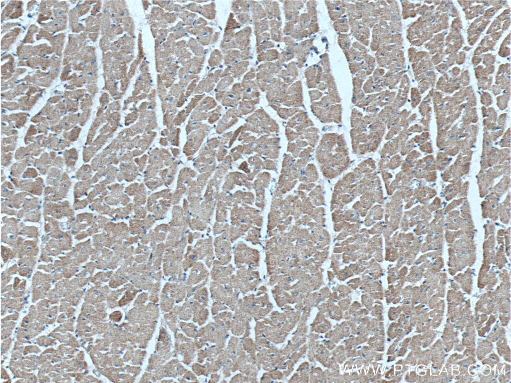 Immunohistochemistry (IHC) staining of human heart tissue using GFRA3 Polyclonal antibody (25379-1-AP)