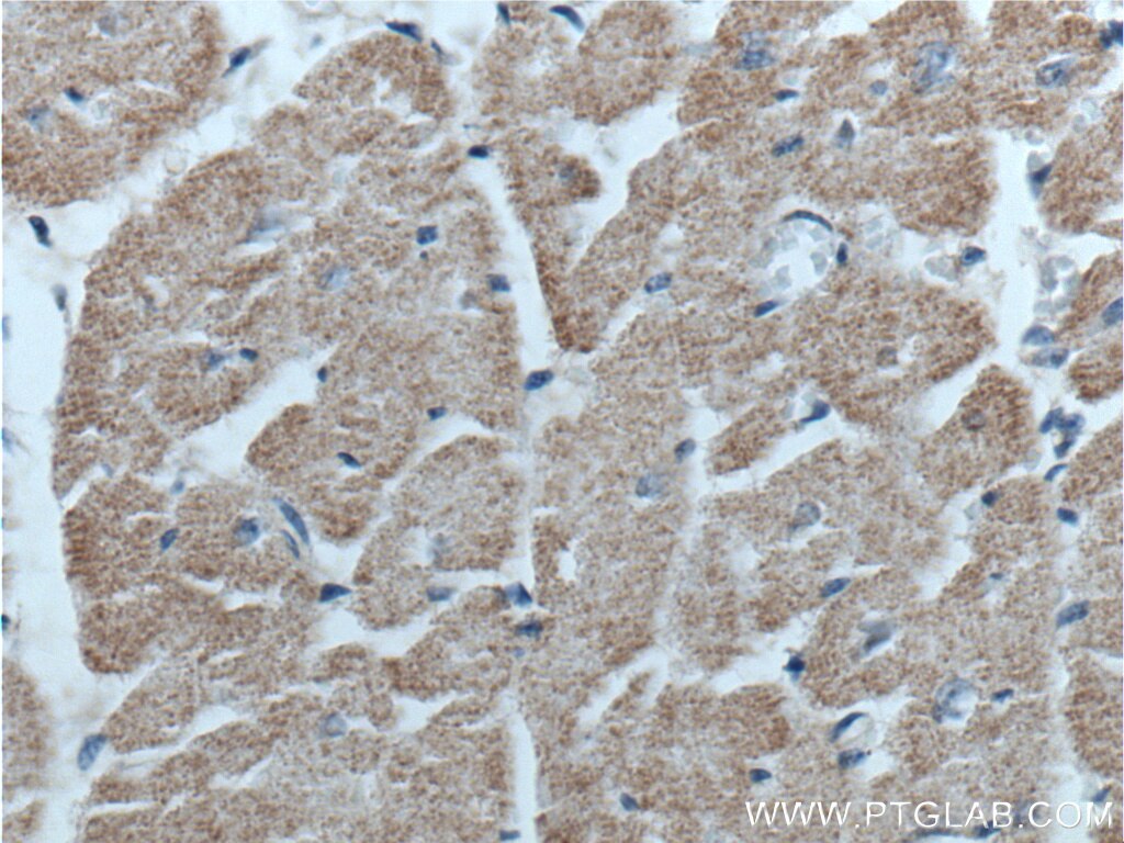 IHC staining of human heart using 25379-1-AP