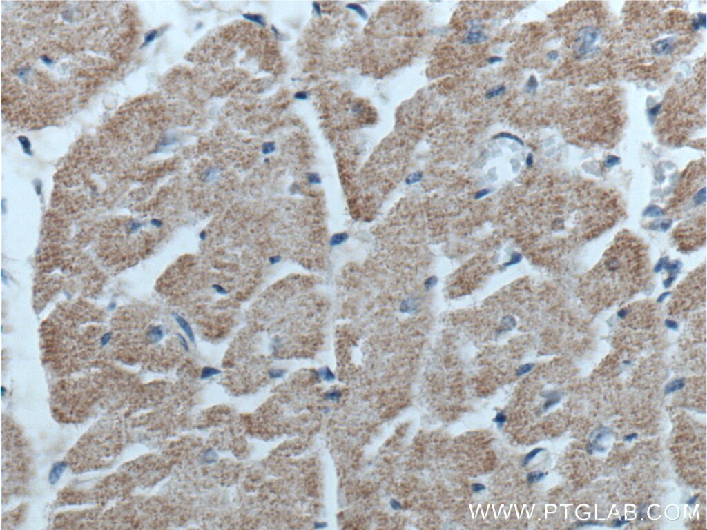 Immunohistochemistry (IHC) staining of human heart tissue using GFRA3 Polyclonal antibody (25379-1-AP)