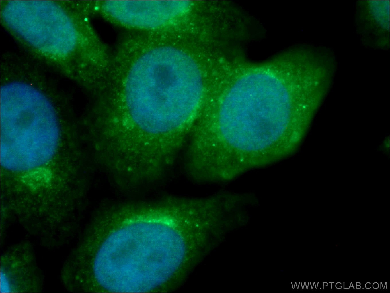 Immunofluorescence (IF) / fluorescent staining of HepG2 cells using GGA1 Polyclonal antibody (25674-1-AP)