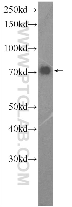 Western Blot (WB) analysis of HEK-293 cells using GGA1 Polyclonal antibody (25674-1-AP)