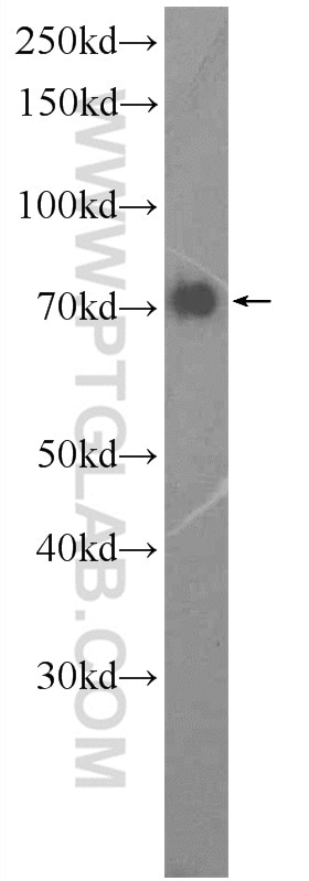 GGA1 Polyclonal antibody
