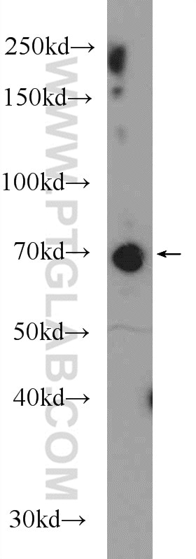 Western Blot (WB) analysis of rat brain tissue using GGA1 Polyclonal antibody (25674-1-AP)