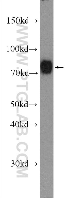 Western Blot (WB) analysis of mouse brain tissue using GGA1 Polyclonal antibody (25674-1-AP)