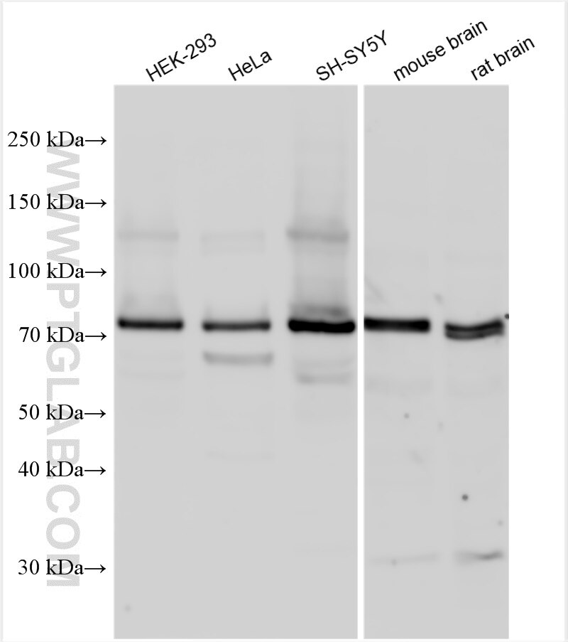 Western Blot (WB) analysis of various lysates using GGA1 Polyclonal antibody (25674-1-AP)