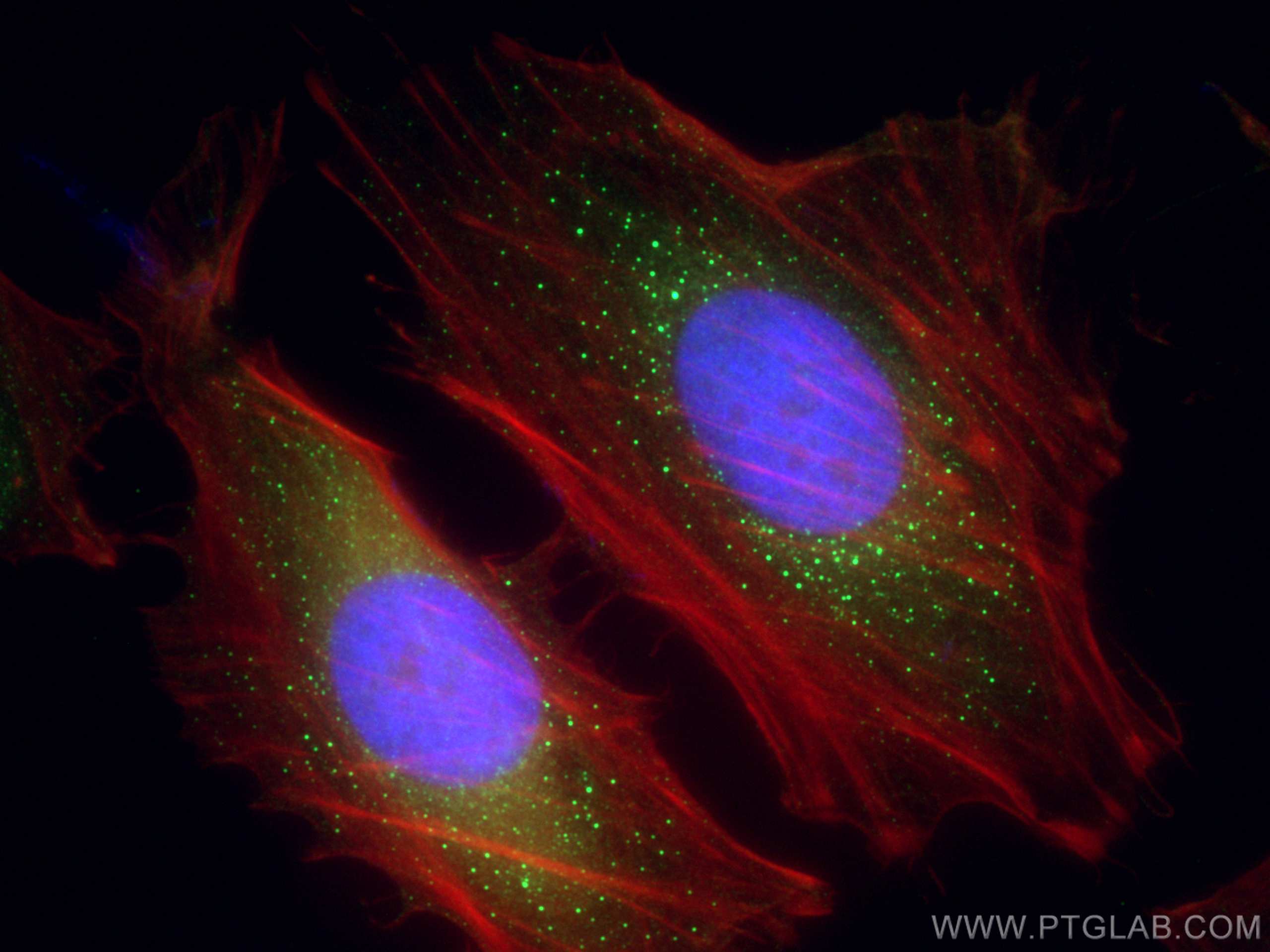 Immunofluorescence (IF) / fluorescent staining of HeLa cells using GGA2 Polyclonal antibody (10356-1-AP)