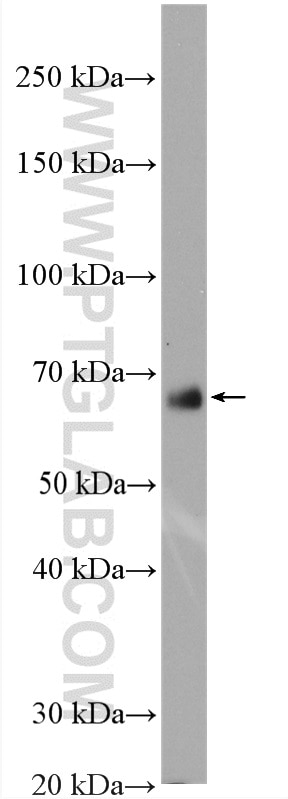 Western Blot (WB) analysis of mouse adipose tissue using GGA2 Polyclonal antibody (10356-1-AP)