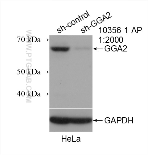 Western Blot (WB) analysis of HeLa cells using GGA2 Polyclonal antibody (10356-1-AP)
