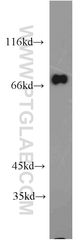 Western Blot (WB) analysis of mouse brain tissue using GGA2 Polyclonal antibody (10356-1-AP)