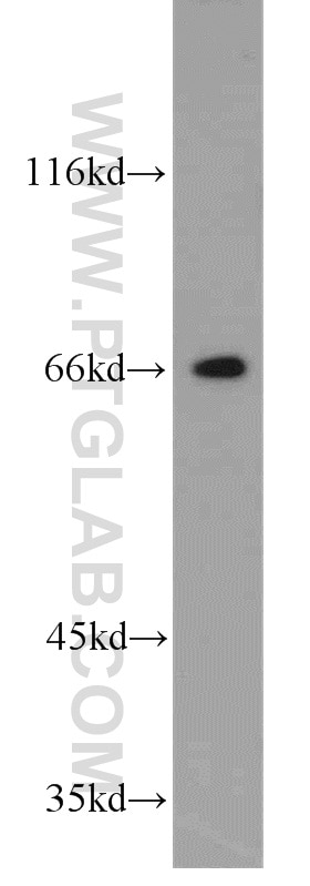 Western Blot (WB) analysis of human kidney tissue using GGA2 Polyclonal antibody (10356-1-AP)