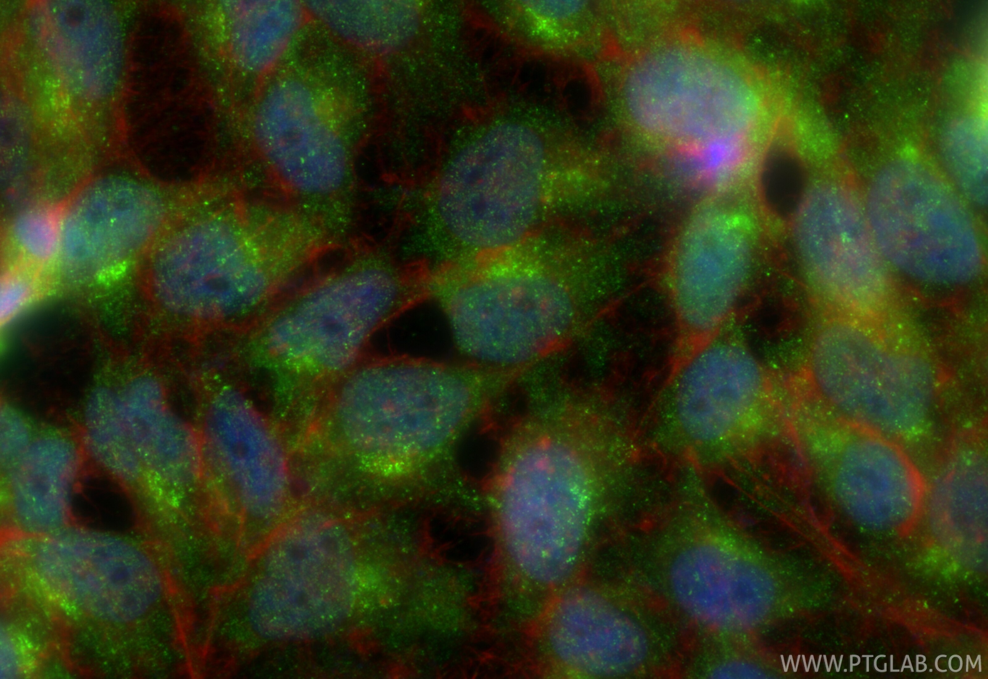 IF Staining of HeLa using 33639-1-AP Immunofluorescence (IF) / fluorescent staining of HeLa cells using GGA3 Polyclonal antibody (33639-1-AP)
