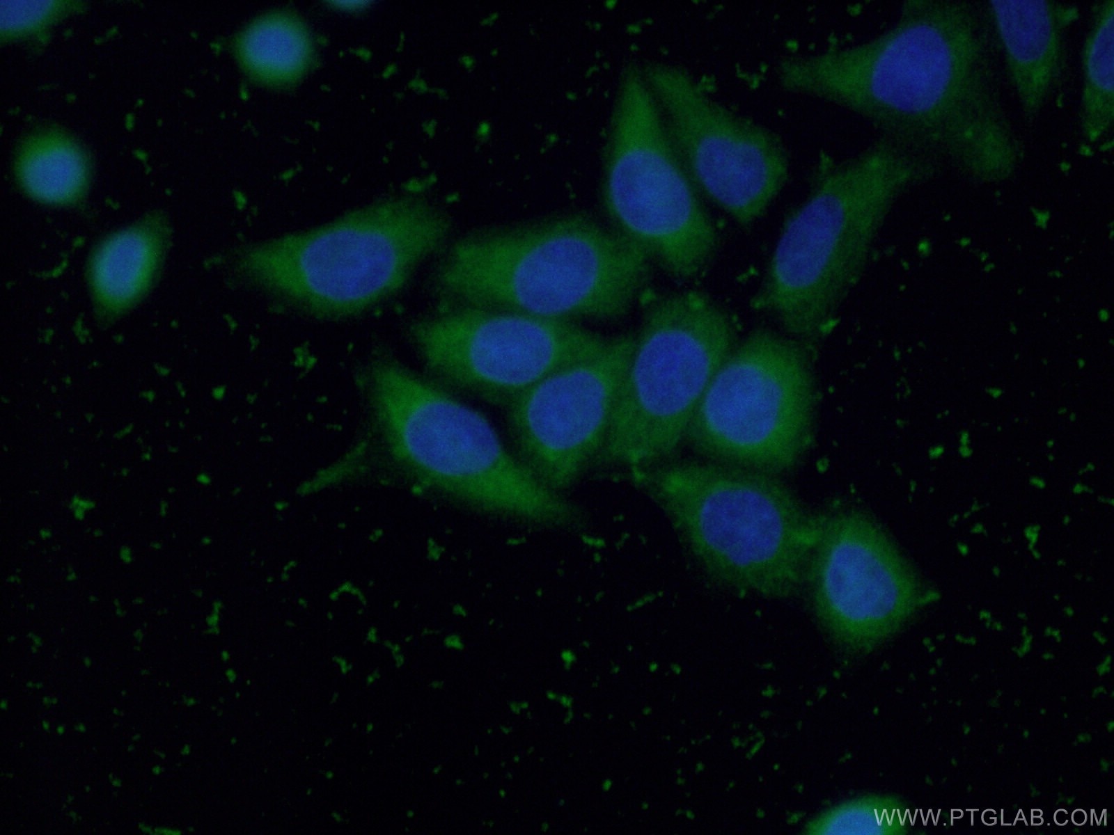 Immunofluorescence (IF) / fluorescent staining of HeLa cells using GGCT Polyclonal antibody (16257-1-AP)