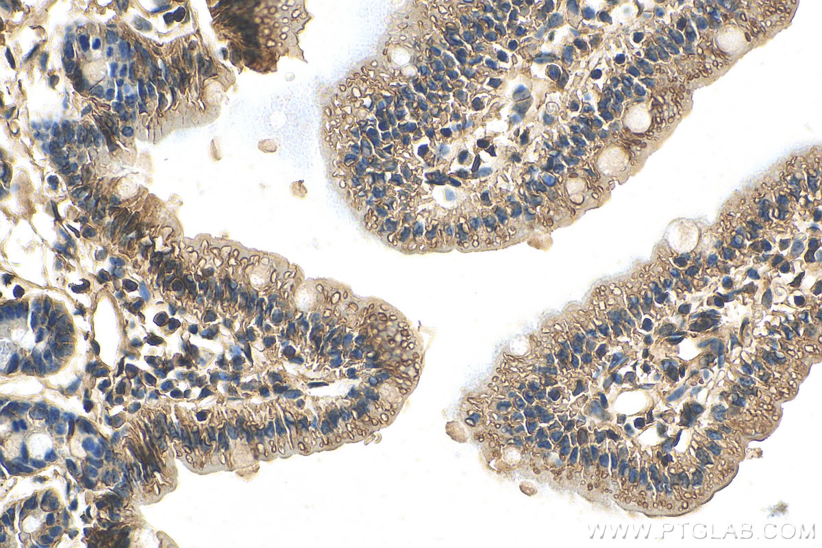 Immunohistochemistry (IHC) staining of mouse small intestine tissue using GGCT Polyclonal antibody (16257-1-AP)