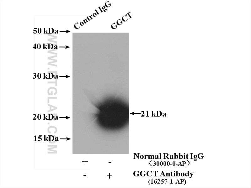 Immunoprecipitation (IP) experiment of mouse kidney tissue using GGCT Polyclonal antibody (16257-1-AP)