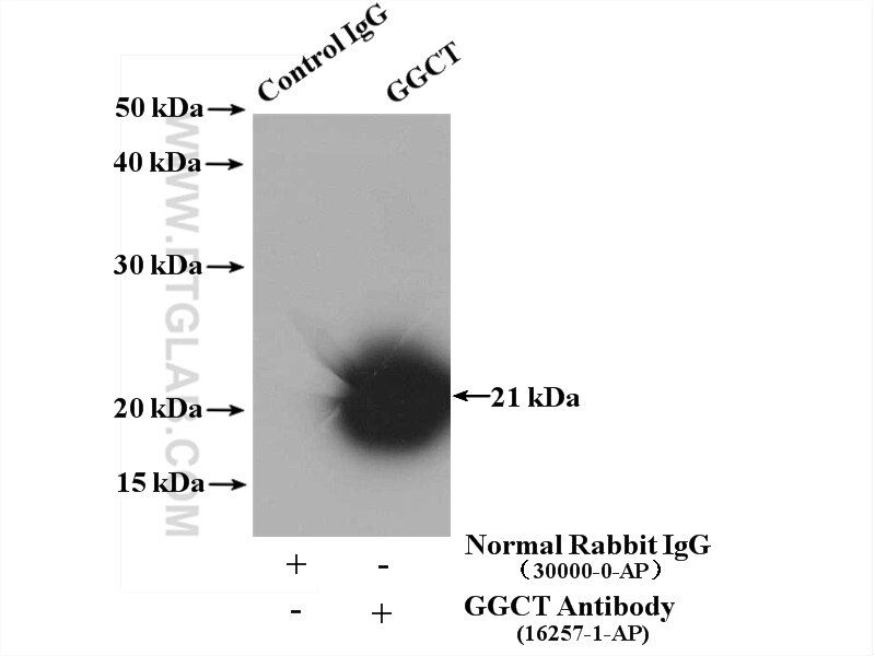 IP experiment of mouse kidney using 16257-1-AP