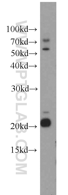 Western Blot (WB) analysis of mouse kidney tissue using GGCT Polyclonal antibody (16257-1-AP)