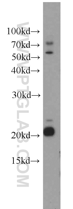 WB analysis of mouse kidney using 16257-1-AP