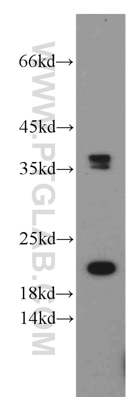 Western Blot (WB) analysis of mouse liver tissue using GGCT Polyclonal antibody (16257-1-AP)