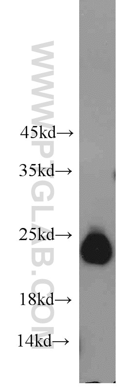 Western Blot (WB) analysis of human brain tissue using GGCT Polyclonal antibody (16257-1-AP)