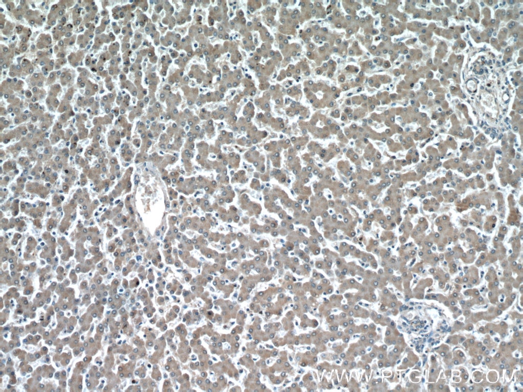 Immunohistochemistry (IHC) staining of human liver tissue using GGCX Polyclonal antibody (16209-1-AP)