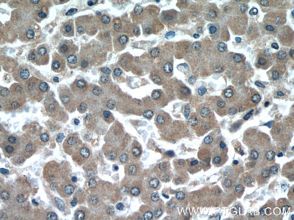 Immunohistochemistry (IHC) staining of human liver tissue using GGCX Polyclonal antibody (16209-1-AP)