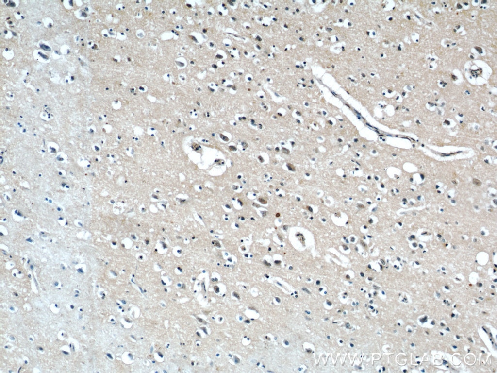 Immunohistochemistry (IHC) staining of human brain tissue using GGCX Polyclonal antibody (16209-1-AP)