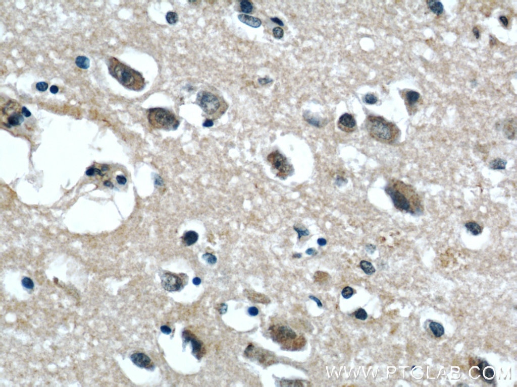 Immunohistochemistry (IHC) staining of human brain tissue using GGCX Polyclonal antibody (16209-1-AP)